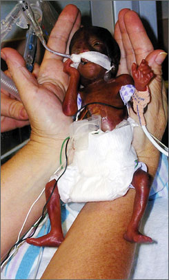 racial equity in the NICU